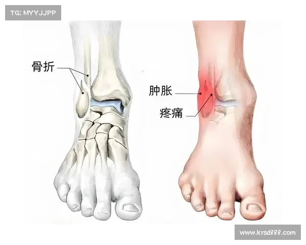 穆西亚拉腓骨骨折伴踝关节脱臼将接受手术并长期缺阵 穆西亚拉腓骨骨折伴踝关节脱臼将接受手术并长期缺阵